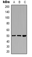 ZFYVE19 Antibody - Western blot analysis of ZFYVE19 expression in Raji (A); A431 (B); HT29 (C) whole cell lysates.