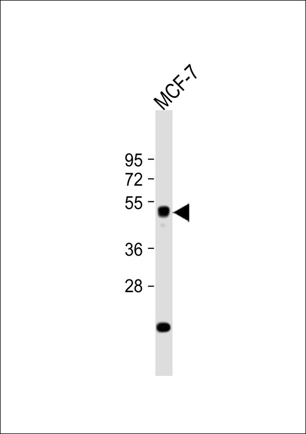 ZFYVE19 Antibody - Anti-ZFYVE19 Antibody at 1:1000 dilution + MCF-7 whole cell lysate Lysates/proteins at 20 ug per lane. Secondary Goat Anti-Rabbit IgG, (H+L), Peroxidase conjugated at 1:10000 dilution. Predicted band size: 52 kDa. Blocking/Dilution buffer: 5% NFDM/TBST.