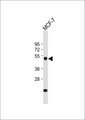 ZFYVE19 Antibody - Anti-ZFYVE19 Antibody at 1:1000 dilution + MCF-7 whole cell lysate Lysates/proteins at 20 ug per lane. Secondary Goat Anti-Rabbit IgG, (H+L), Peroxidase conjugated at 1:10000 dilution. Predicted band size: 52 kDa. Blocking/Dilution buffer: 5% NFDM/TBST.