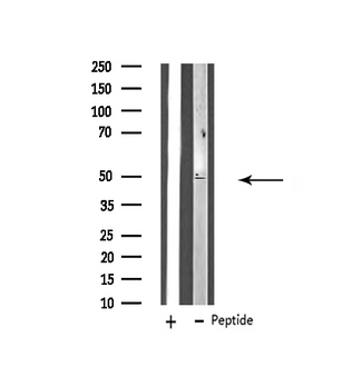 ZFYVE19 Antibody - Western blot analysis of extracts of HT29 cells using ZFYVE19 antibody.