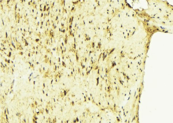 ZFYVE19 Antibody - 1:100 staining mouse muscle tissue by IHC-P. The sample was formaldehyde fixed and a heat mediated antigen retrieval step in citrate buffer was performed. The sample was then blocked and incubated with the antibody for 1.5 hours at 22°C. An HRP conjugated goat anti-rabbit antibody was used as the secondary.
