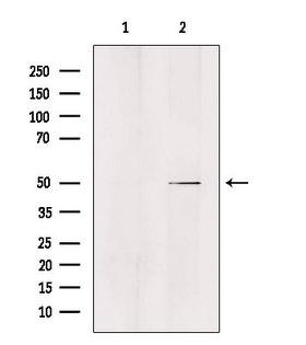 ZFYVE19 Antibody - Western blot analysis of extracts of HeLa cells using ZFYVE19 antibody. Lane 1 was treated with the blocking peptide.