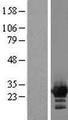 ZFYVE21 Protein - Western validation with an anti-DDK antibody * L: Control HEK293 lysate R: Over-expression lysate