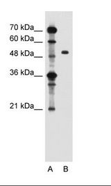 ZFYVE27 / Protrudin Antibody - A: Marker, B: Jurkat Cell Lysate.  This image was taken for the unconjugated form of this product. Other forms have not been tested.