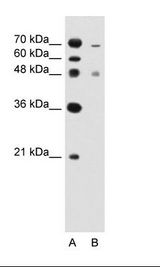ZFYVE27 / Protrudin Antibody - A: Marker, B: Jurkat Cell Lysate.  This image was taken for the unconjugated form of this product. Other forms have not been tested.