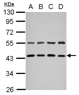 ZFYVE27 / Protrudin Antibody - Sample (30 ug of whole cell lysate) A: NT2D1 B: PC-3 C: U87-MG D: SK-N-SH 10% SDS PAGE ZFYVE27 antibody diluted at 1:1000