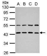 ZFYVE27 / Protrudin Antibody - Sample (30 ug of whole cell lysate) A: NT2D1 B: PC-3 C: U87-MG D: SK-N-SH 10% SDS PAGE ZFYVE27 antibody diluted at 1:1000