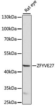 ZFYVE27 / Protrudin Antibody - Western blot analysis of extracts of rat eye using ZFYVE27 Polyclonal Antibody at dilution of 1:1000.