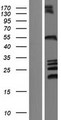 ZFYVE27 / Protrudin Protein - Western validation with an anti-DDK antibody * L: Control HEK293 lysate R: Over-expression lysate