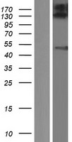 ZFYVE27 / Protrudin Protein - Western validation with an anti-DDK antibody * L: Control HEK293 lysate R: Over-expression lysate