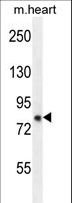ZFYVE28 Antibody - ZFYVE28 Antibody western blot of mouse heart tissue lysates (35 ug/lane). The ZFYVE28 antibody detected the ZFYVE28 protein (arrow).