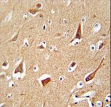 ZFYVE28 Antibody - ZFYVE28 antibody immunohistochemistry of formalin-fixed and paraffin-embedded human brain tissue followed by peroxidase-conjugated secondary antibody and DAB staining.