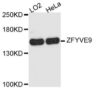 ZFYVE9 / SARA Antibody - Western blot analysis of extracts of various cell lines.