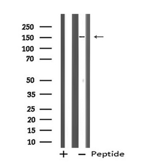 ZFYVE9 / SARA Antibody - Western blot analysis of ZFYVE9 using HeLa whole cells lysates