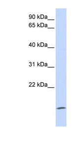 ZG16 Antibody - ZG16 antibody Western blot of Fetal Brain lysate. This image was taken for the unconjugated form of this product. Other forms have not been tested.
