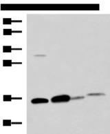 ZG16 Antibody - Western blot analysis of Human sigmoid tissue Mouse large intestine tissue Mouse small intestines tissue Mouse Pancreas tissue lysates  using ZG16 Polyclonal Antibody at dilution of 1:800