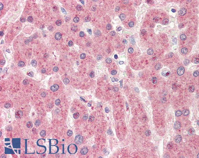 ZGPAT Antibody - Human, Liver: Formalin-Fixed Paraffin-Embedded (FFPE).  This image was taken for the unconjugated form of this product. Other forms have not been tested.