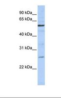 ZGPAT Antibody - 721_B cell lysate. Antibody concentration: 1.0 ug/ml. Gel concentration: 12%.  This image was taken for the unconjugated form of this product. Other forms have not been tested.