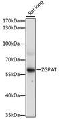 ZGPAT Antibody - Western blot analysis of extracts of rat lung using ZGPAT Polyclonal Antibody at dilution of 1:1000.