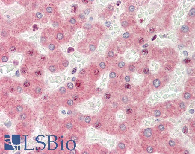 ZGPAT Antibody - Anti-ZGPAT antibody IHC staining of human liver. Immunohistochemistry of formalin-fixed, paraffin-embedded tissue after heat-induced antigen retrieval.  This image was taken for the unconjugated form of this product. Other forms have not been tested.