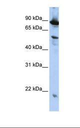 ZGPAT Antibody - HepG2 cell lysate. Antibody concentration: 1.0 ug/ml. Gel concentration: 12%.  This image was taken for the unconjugated form of this product. Other forms have not been tested.