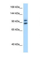 ZHX1 Antibody - ZHX1 antibody Western blot of PANC1 Cell lysate. Antibody concentration 1 ug/ml.  This image was taken for the unconjugated form of this product. Other forms have not been tested.