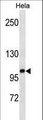 ZHX1 Antibody - ZHX1 Antibody western blot of HeLa cell line lysates (35 ug/lane). The ZHX1 antibody detected the ZHX1 protein (arrow).