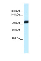 ZHX1 Antibody - ZHX1 antibody Western blot of Mouse Heart lysate. Antibody concentration 1 ug/ml.  This image was taken for the unconjugated form of this product. Other forms have not been tested.
