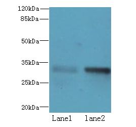 ZHX1 Antibody - Western blot. All lanes: ZHX1-C8orf76 antibody at 2 ug/ml. Lane 1: Mouse heart tissue. Lane 2: Mouse kidney tissue. Secondary Goat polyclonal to Rabbit IgG at 1:10000 dilution. Predicted band size: 33 kDa. Observed band size: 33 kDa.