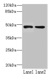 ZHX1 Antibody - Western blot All lanes: ZHX1-C8orf76 antibody at 2µg/ml Lane 1: Mouse heart tissue Lane 2: Mouse kidney tissue Secondary Goat polyclonal to rabbit IgG at 1/10000 dilution Predicted band size: 33 kDa Observed band size: 33 kDa