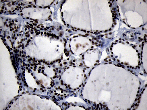 ZHX2 / RAF Antibody - Immunohistochemical staining of paraffin-embedded Human thyroid tissue within the normal limits using anti-ZHX2 mouse monoclonal antibody. (Heat-induced epitope retrieval by 1mM EDTA in 10mM Tris buffer. (pH8.5) at 120°C for 3 min. (1:150)
