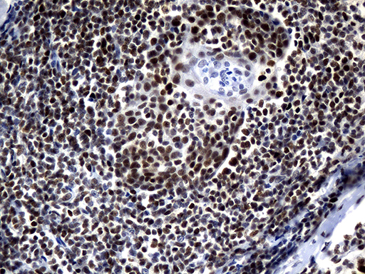 ZHX2 / RAF Antibody - Immunohistochemical staining of paraffin-embedded Human tonsil within the normal limits using anti-ZHX2 mouse monoclonal antibody. (Heat-induced epitope retrieval by 1mM EDTA in 10mM Tris buffer. (pH8.5) at 120°C for 3 min. (1:150)
