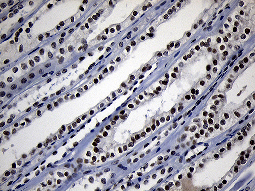 ZHX2 / RAF Antibody - Immunohistochemical staining of paraffin-embedded Human Kidney tissue within the normal limits using anti-ZHX2 mouse monoclonal antibody. (Heat-induced epitope retrieval by 1mM EDTA in 10mM Tris buffer. (pH8.5) at 120°C for 3 min. (1:150)
