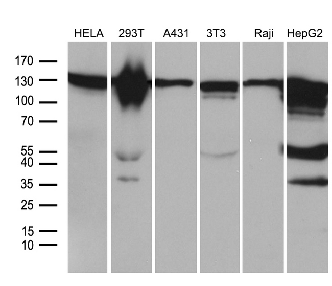 ZHX2 / RAF Antibody - Western blot analysis of extracts. (35ug) from 6 different cell lines by using anti-ZHX2 monoclonal antibody. (1:500)