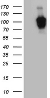 ZHX2 / RAF Antibody - HEK293T cells were transfected with the pCMV6-ENTRY control. (Left lane) or pCMV6-ENTRY ZHX2. (Right lane) cDNA for 48 hrs and lysed. Equivalent amounts of cell lysates. (5 ug per lane) were separated by SDS-PAGE and immunoblotted with anti-ZHX2. (1:2000)