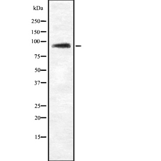 ZHX2 / RAF Antibody - Western blot analysis of ZHX2 using Jurkat whole cells lysates