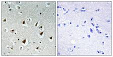 ZHX2 / RAF Antibody - Peptide - + Immunohistochemistry analysis of paraffin-embedded human brain tissue, using ZHX2 antibody.