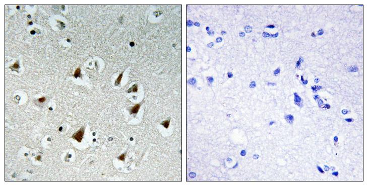 ZHX2 / RAF Antibody - Peptide - + Immunohistochemistry analysis of paraffin-embedded human brain tissue, using ZHX2 antibody.