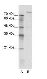 ZHX2 / RAF Antibody - A: Marker, B: Jurkat Cell Lysate.  This image was taken for the unconjugated form of this product. Other forms have not been tested.