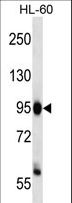 ZHX3 Antibody - ZHX3 Antibody western blot of HL-60 cell line lysates (35 ug/lane). The ZHX3 antibody detected the ZHX3 protein (arrow).