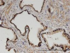 ZHX3 Antibody - Immunoperoxidase of monoclonal antibody to ZHX3 on formalin-fixed paraffin-embedded human prostate. [antibody concentration 3 ug/ml]