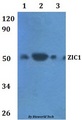ZIC / ZIC1 Antibody - Western blot of ZIC1 antibody at 1:500 dilution. Lane 1: HEK293T whole cell lysate. Lane 2: RAW264.7 whole cell lysate.