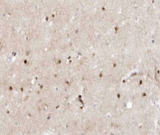 ZIC / ZIC1 Antibody - 1:100 staining human brain tissue by IHC-P. The tissue was formaldehyde fixed and a heat mediated antigen retrieval step in citrate buffer was performed. The tissue was then blocked and incubated with the antibody for 1.5 hours at 22°C. An HRP conjugated goat anti-rabbit antibody was used as the secondary.