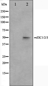 ZIC / ZIC1 Antibody - Western blot analysis on Jurkat cell lysates using ZIC1/2/3 antibody. The lane on the left is treated with the antigen-specific peptide.