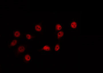 ZIC / ZIC1 Antibody - Staining HeLa cells by IF/ICC. The samples were fixed with PFA and permeabilized in 0.1% Triton X-100, then blocked in 10% serum for 45 min at 25°C. The primary antibody was diluted at 1:200 and incubated with the sample for 1 hour at 37°C. An Alexa Fluor 594 conjugated goat anti-rabbit IgG (H+L) Ab, diluted at 1/600, was used as the secondary antibody.