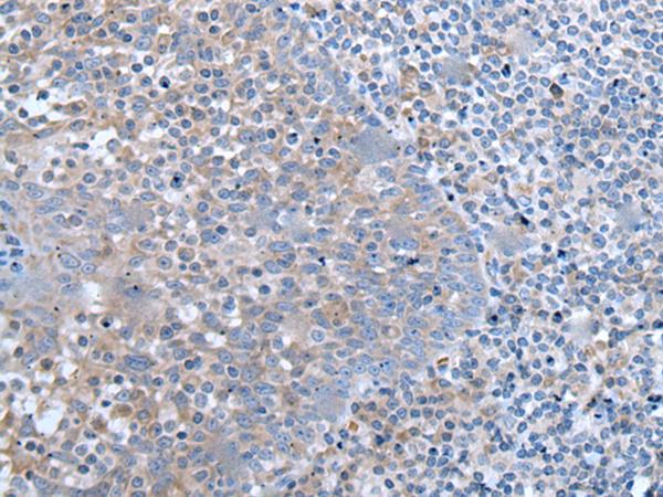 ZIC / ZIC1 Antibody - Immunohistochemistry of paraffin-embedded Human tonsil tissue  using ZIC1 Polyclonal Antibody at dilution of 1:65(×200)