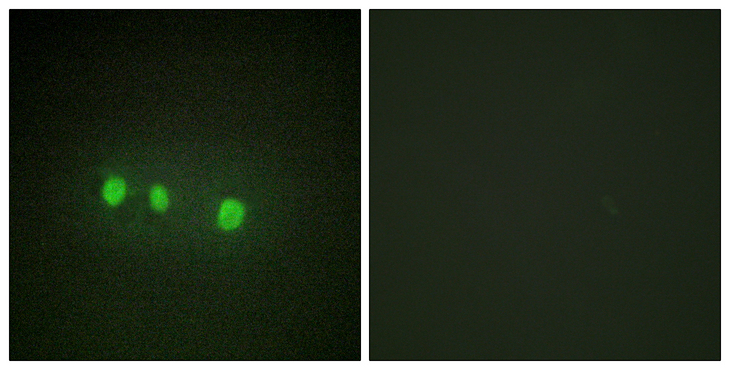 ZIC1+2+3+4+5 Antibody - Immunofluorescence analysis of HepG2 cells, using ZIC1/2/3/4/5 Antibody. The picture on the right is blocked with the synthesized peptide.