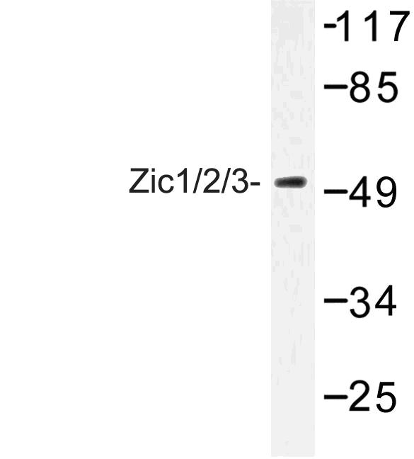 ZIC1+2+3 Antibody - Western blot of Zic1/2/3 (D348) pAb in extracts from Jurkat cells.