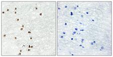 ZIC1+2+3 Antibody - Immunohistochemistry analysis of paraffin-embedded human brain tissue, using ZIC1/2/3 Antibody. The picture on the right is blocked with the synthesized peptide.