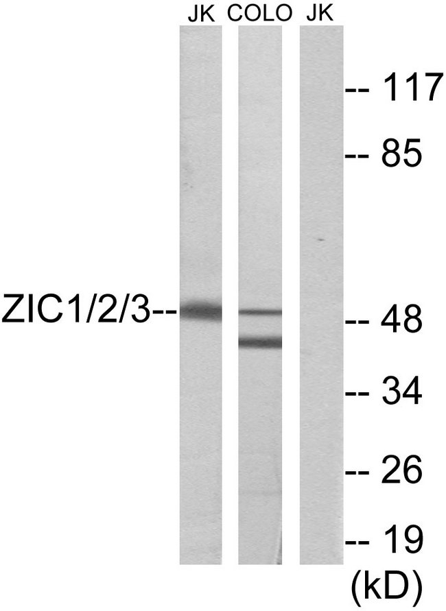 ZIC1+2+3 Antibody - Western blot analysis of lysates from Jurkat and COLO cells, using ZIC1/2/3 Antibody. The lane on the right is blocked with the synthesized peptide.